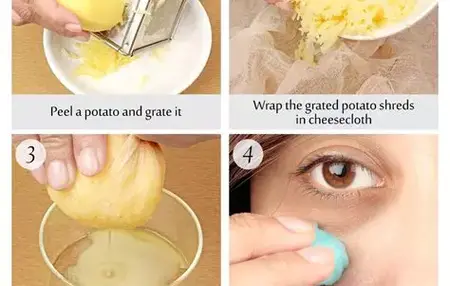How to Get Rid of Dark Circles Under Your Eyes